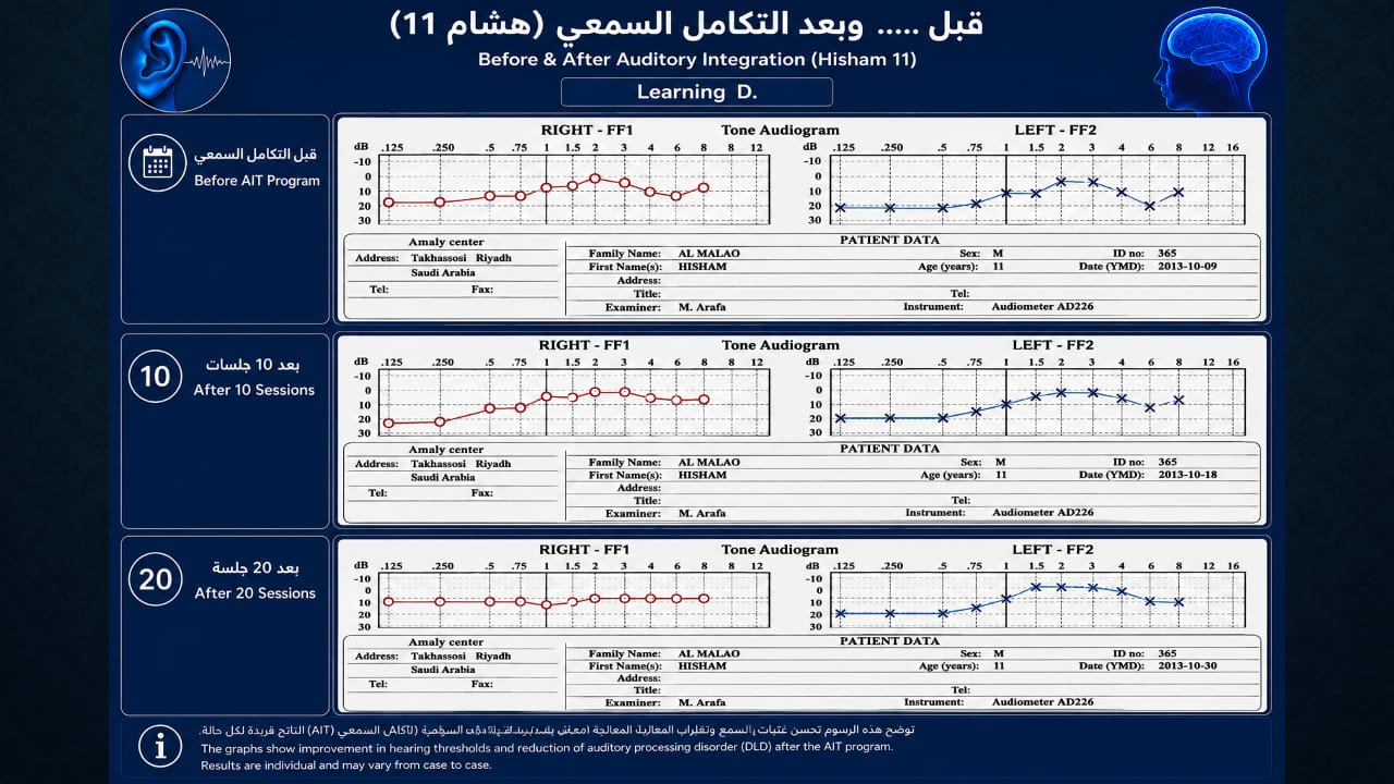 أجزاء من محاضرة اضطراب المعالجة السمعية — صورة 26