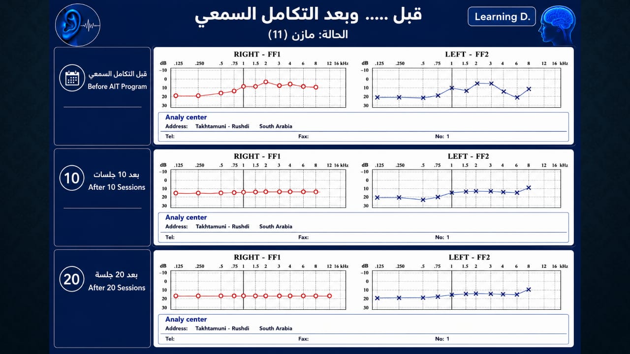أجزاء من محاضرة اضطراب المعالجة السمعية — صورة 27