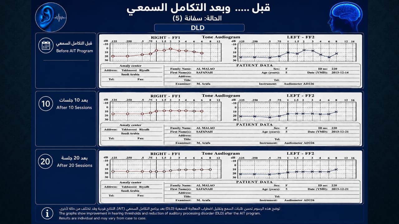 أجزاء من محاضرة اضطراب المعالجة السمعية — صورة 25
